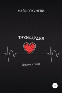 Тахикардия